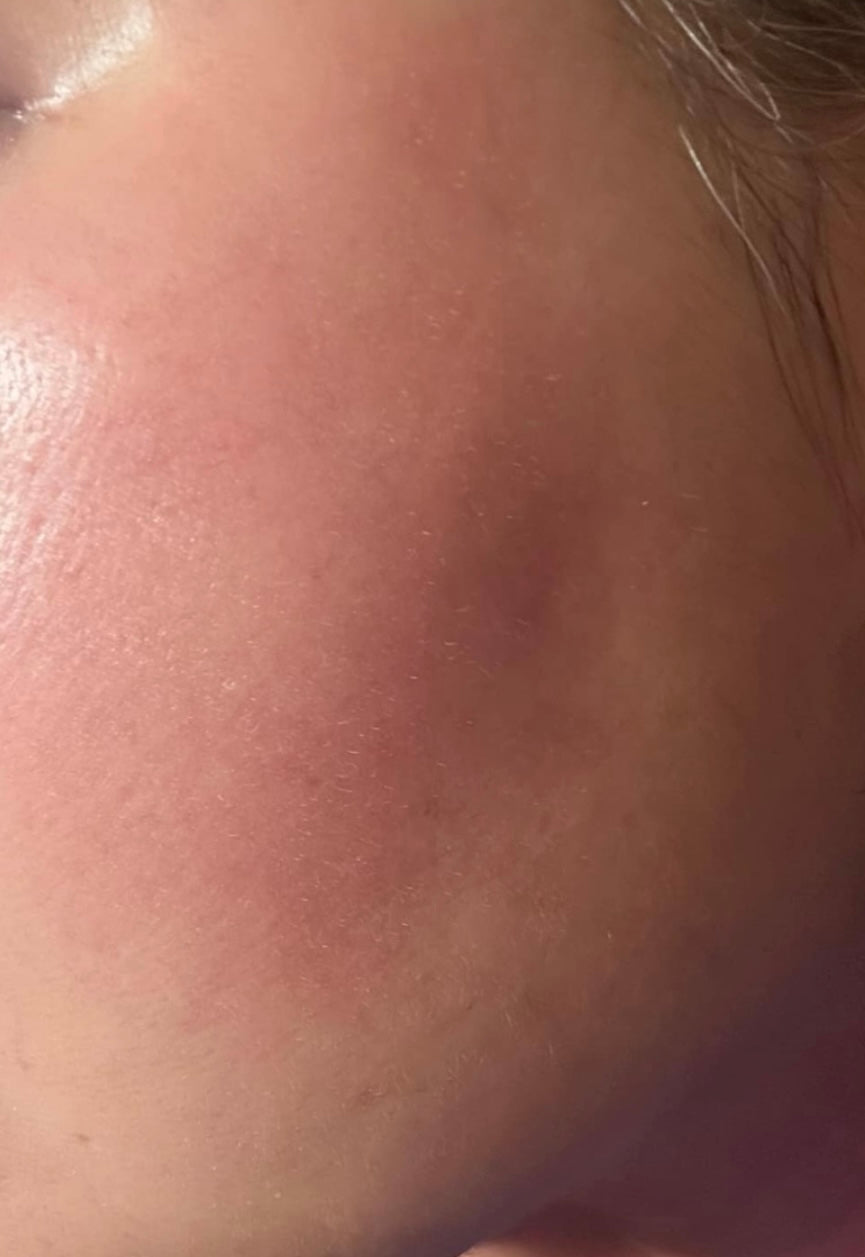 CONCENTRATED PEPTIDE MOISTURIZING CREAM