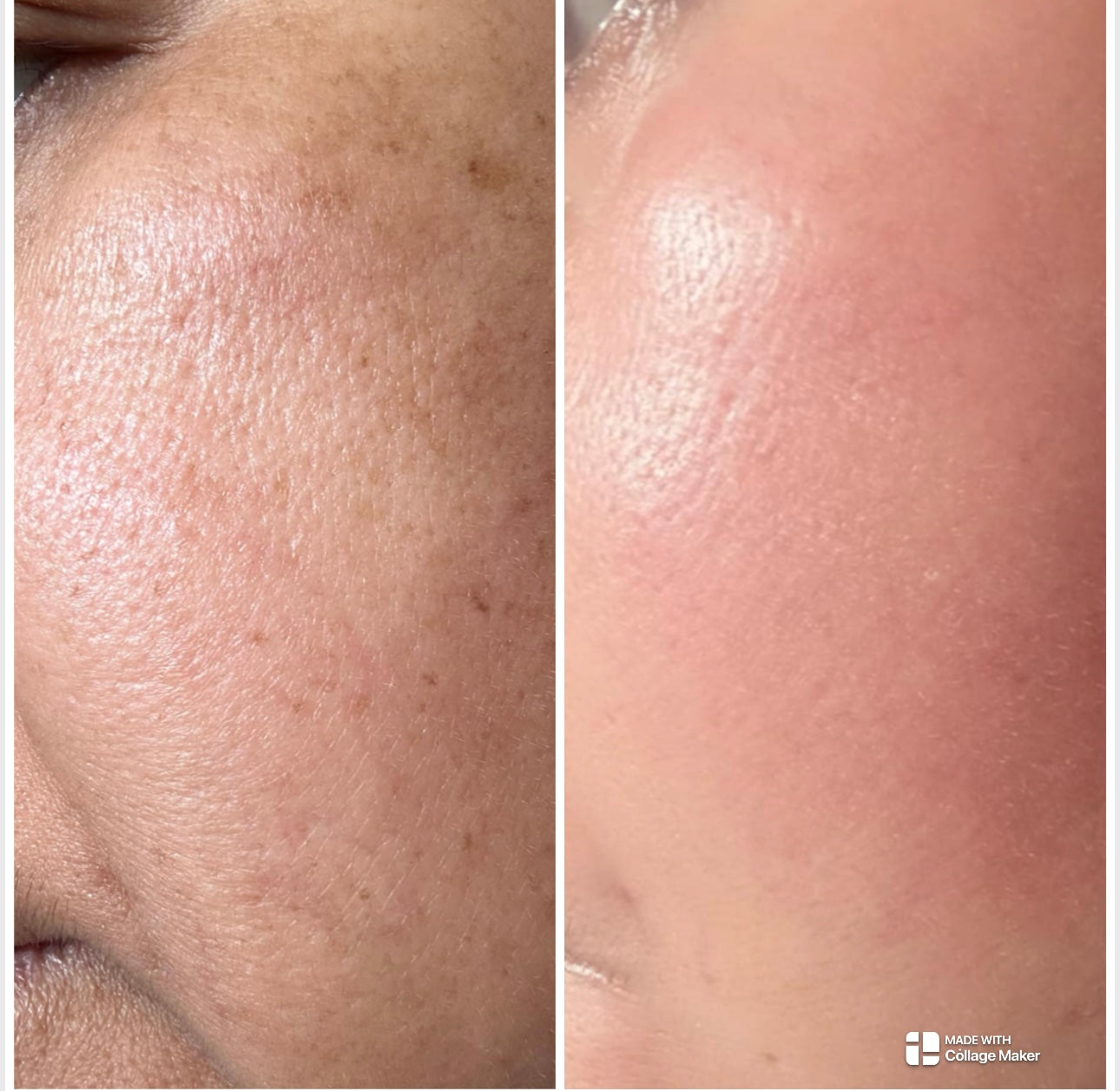 Brightening Ampoule